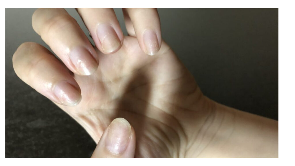 爪の形は変わるって本当 綺麗に爪を伸ばす為に今日から出来る ７つの方法 Ocolog